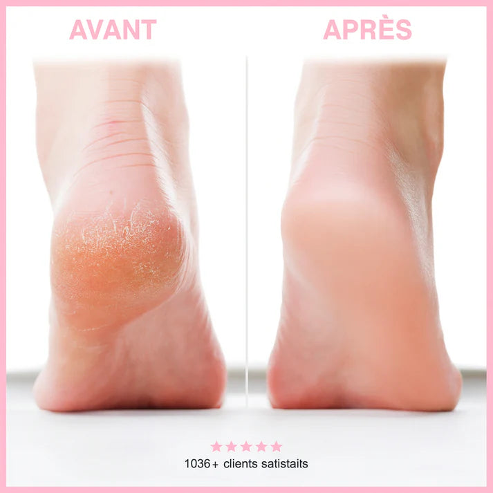 Sillenya SkinPro™ - Kit Beauté Pieds