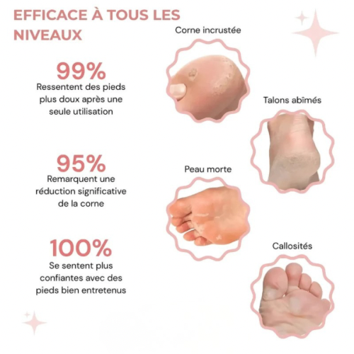 Sillenya SkinPro™ - Kit Beauté Pieds